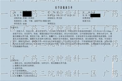 宫颈鳞癌好治吗?泰和肿瘤医院广药三院肿瘤