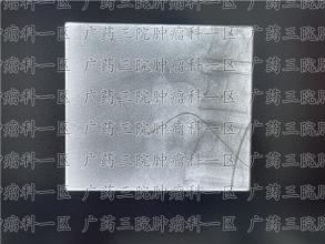 化疗后没有食欲要怎么调理？