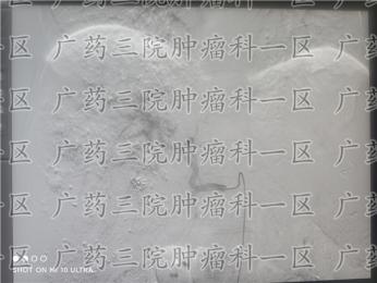 广东汕尾肝肿瘤并发症治疗医院