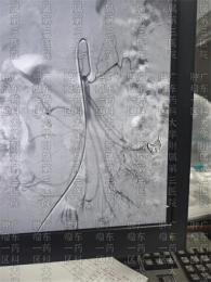 癌症晚期明明治不好，还有必要花钱去治疗吗