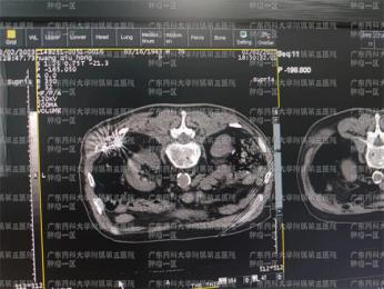 #癌痛到底有没有办法缓解#广药三院肿瘤科